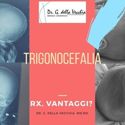 Trigonocefalia e Osteopatia, facciamo il punto.